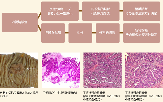 予防と検査