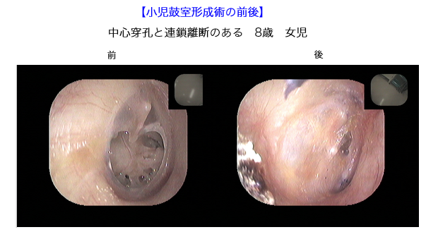 otolaryngology1