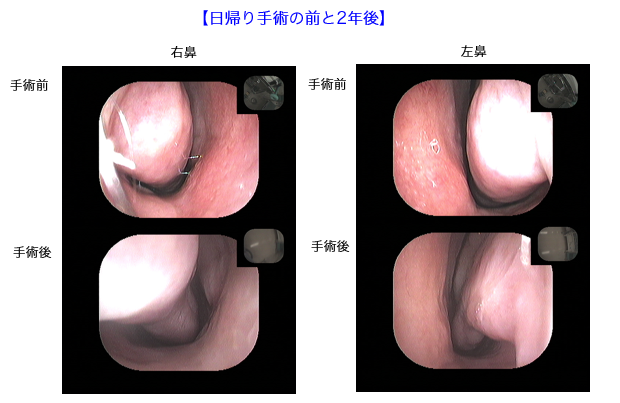 otolaryngology3