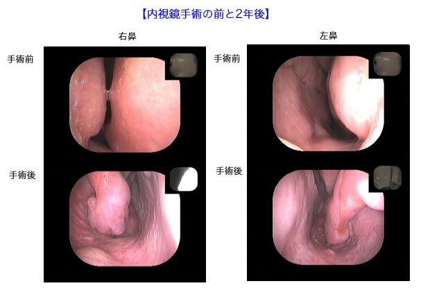 otolaryngology4